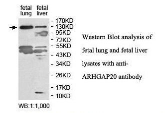 ARHGAP20 Antibody