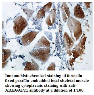 ARHGAP21 Antibody