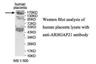 ARHGAP21 Antibody