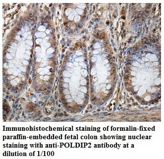 POLDIP2 Antibody