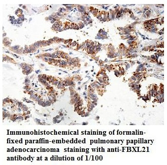 FBXL21 Antibody