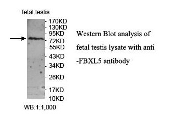 FBXL5 Antibody