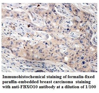 FBXO10 Antibody