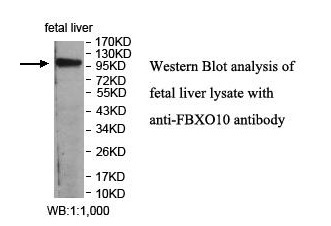 FBXO10 Antibody