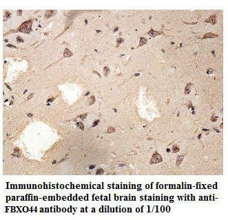 FBXO44 Antibody