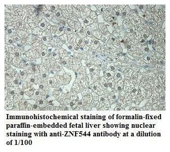 ZNF544 Antibody