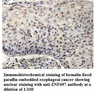 ZNF697 Antibody