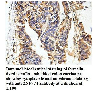 ZNF774 Antibody