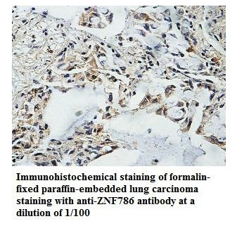 ZNF786 Antibody