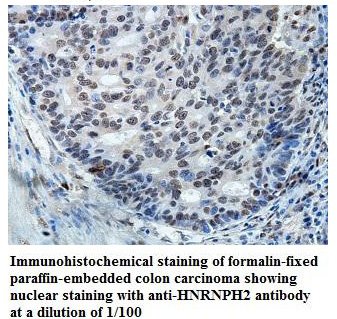 HNRNPH2 Antibody