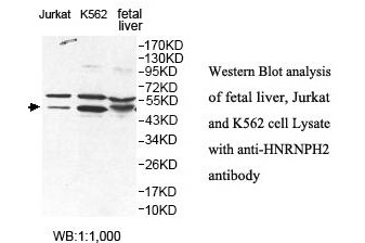 HNRNPH2 Antibody