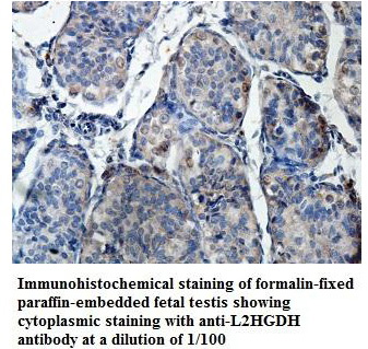 L2HGDH Antibody