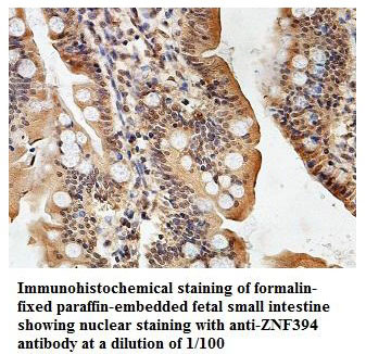 ZNF394 Antibody