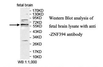 ZNF394 Antibody