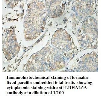 LDHAL6A Antibody