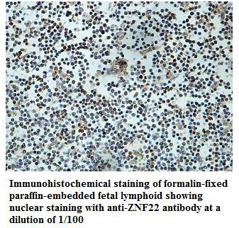 ZNF22 Antibody