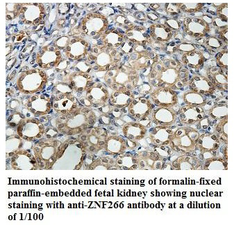 ZNF266 Antibody