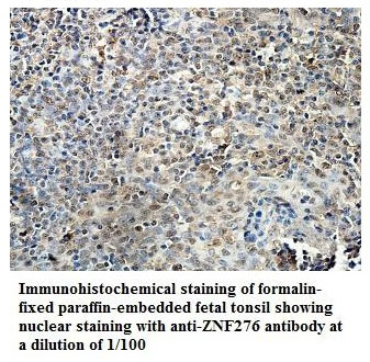 ZNF276 Antibody