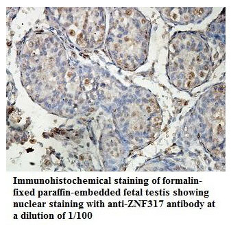 ZNF317 Antibody