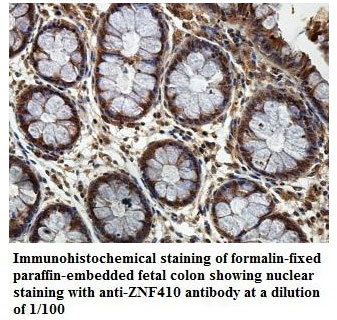 ZNF410 Antibody