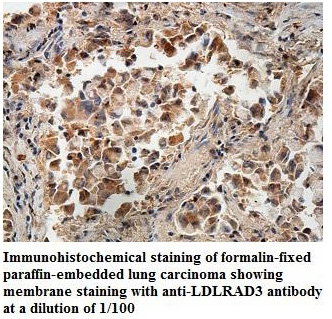 LDLRAD3 Antibody