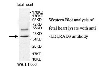 LDLRAD3 Antibody