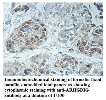 ARHGDIG Antibody