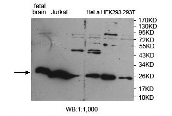 ARHGDIG Antibody