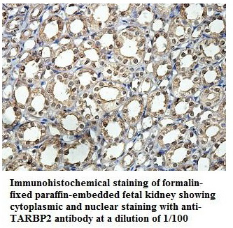 TARBP2 Antibody