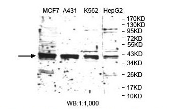 TARBP2 Antibody