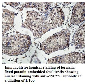 ZNF230 Antibody