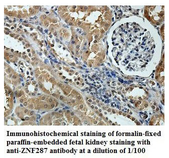 ZNF287 Antibody