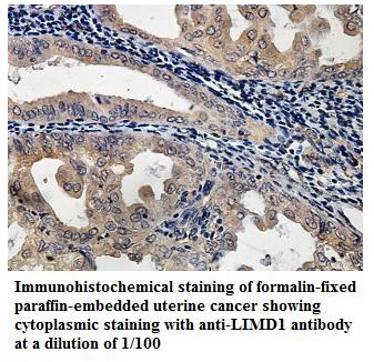 LIMD1 Antibody