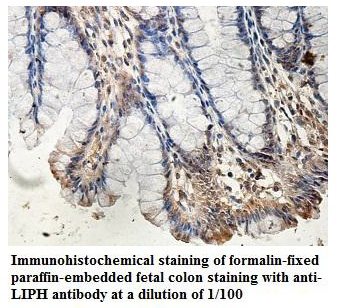 LIPH Antibody