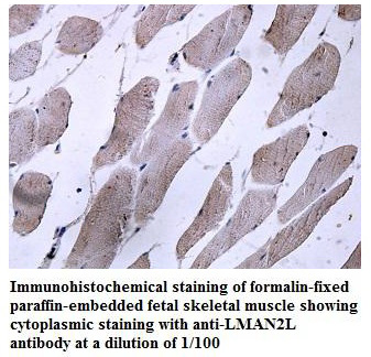 LMAN2L Antibody