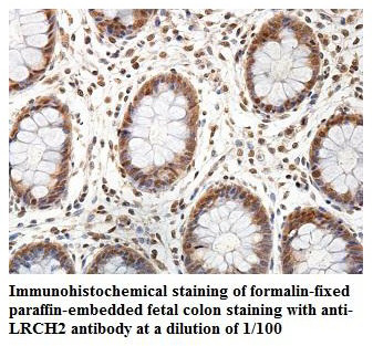 LRCH2 Antibody