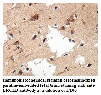 LRCH3 Antibody