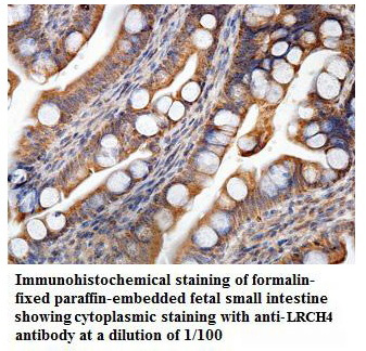 LRCH4 Antibody