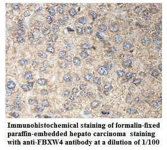 FBXW4 Antibody