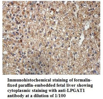 LPGAT1 Antibody