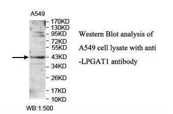 LPGAT1 Antibody