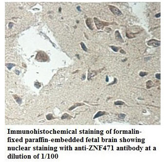 ZNF471 Antibody