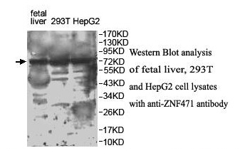 ZNF471 Antibody