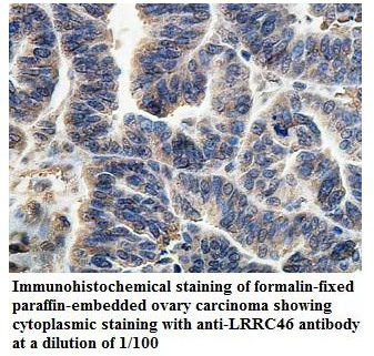 LRRC46 Antibody