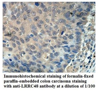 LRRC48 Antibody