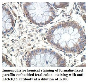 LRRIQ3 Antibody