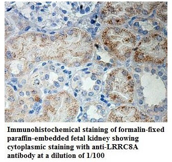 LRRC8A Antibody