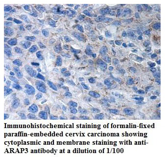 ARAP3 Antibody