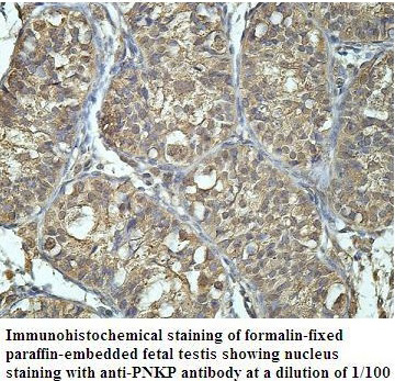 PNKP Antibody