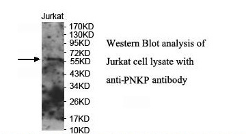 PNKP Antibody